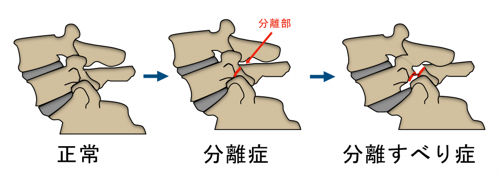 腰の痛みでお困りの方へ 井出整形外科内科クリニック