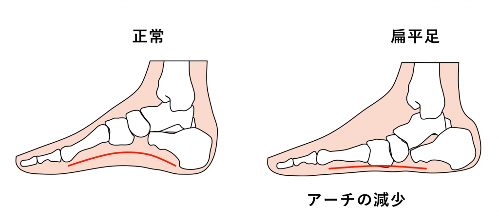 足首 足の痛みでお困りの方へ 井出整形外科内科クリニック