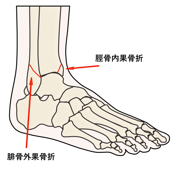 足首 足の痛みでお困りの方へ 井出整形外科内科クリニック