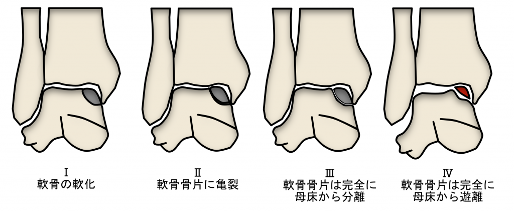 スポーツ中の痛みでお困りの方 井出整形外科内科クリニック