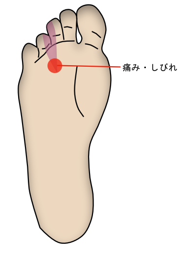 足首 足の痛みでお困りの方へ 井出整形外科内科クリニック