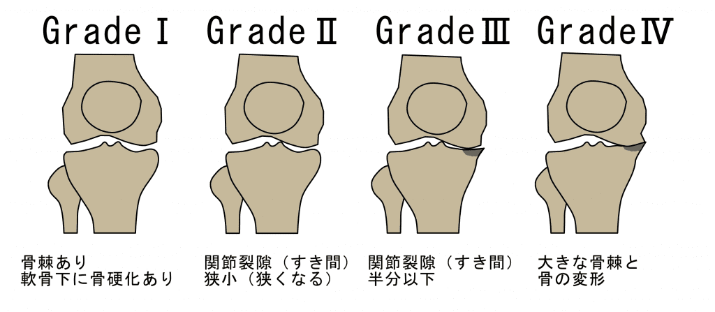 半月板損傷 Sports Medicine Library ザムスト Zamst